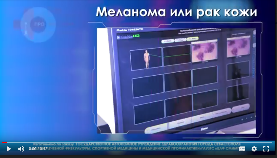 «Меланома или рак»
